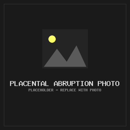 Placeholder — Placental Abruption Photo